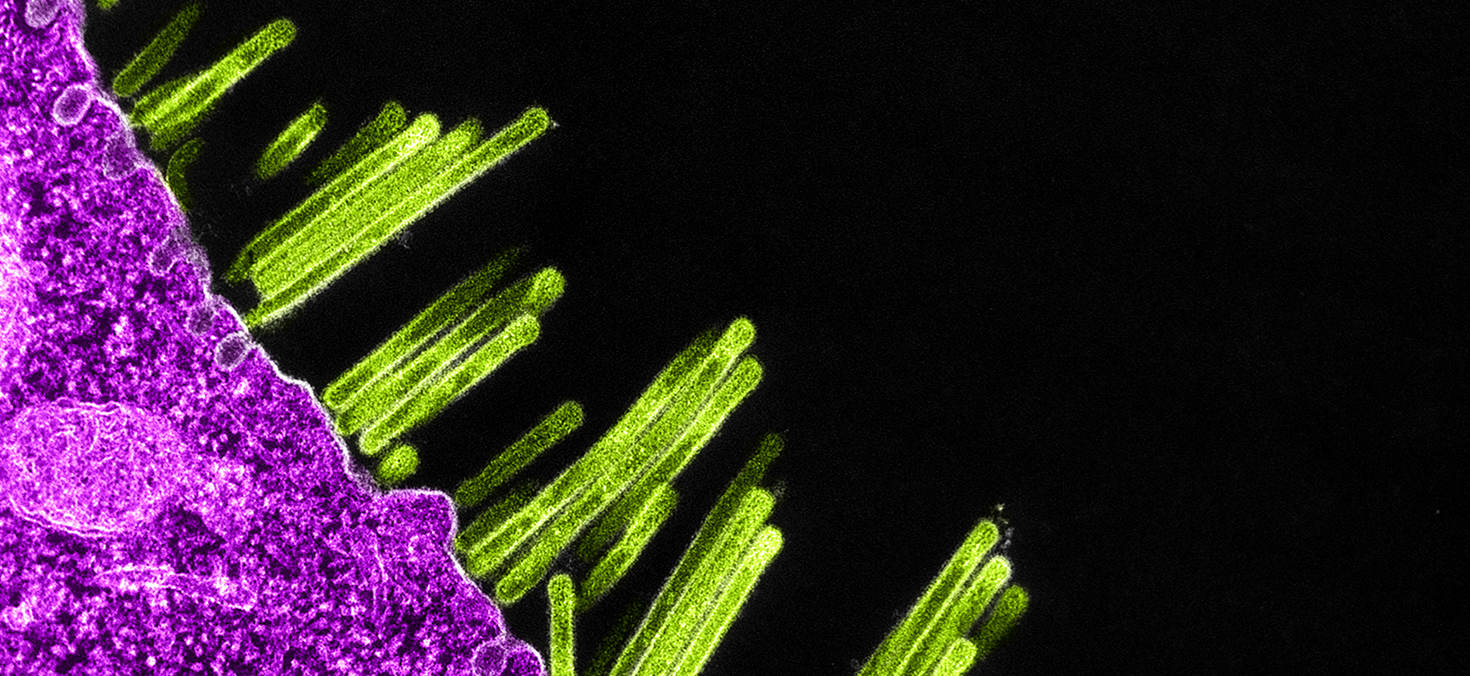 Zoonosen: Prime-Time für Erreger