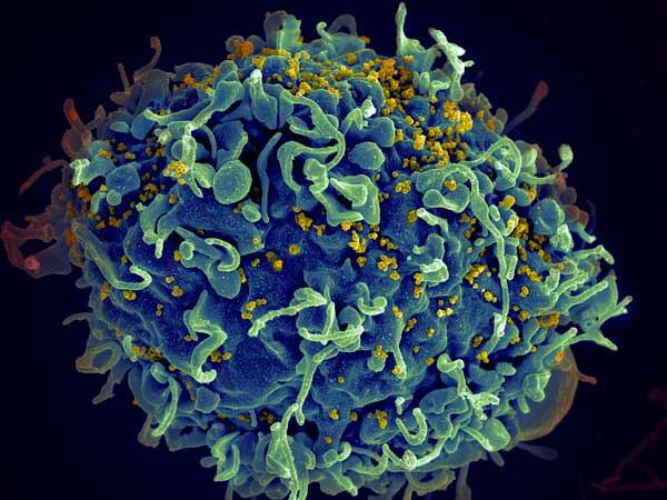 HIV Breakthrough